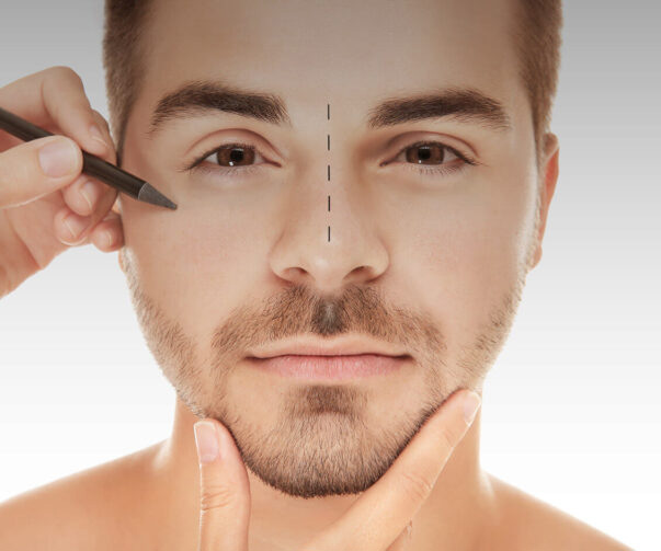 rinoplastiaimg copia